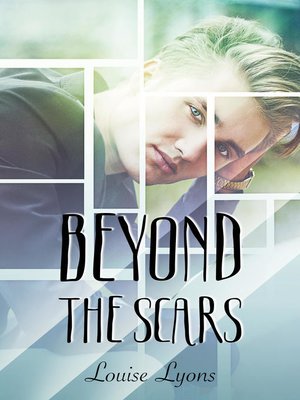 cover image of Beyond the Scars